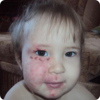 Лечение Дианы Вахитовой. Часть средств возвращена